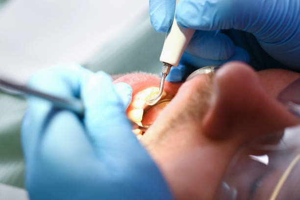 Best After-Hours Emergency Dentist in Knoxvle, IL