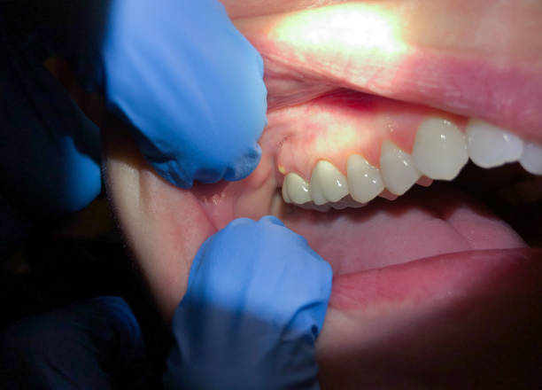 Best Emergency Dental Surgery in Knoxvle, IL