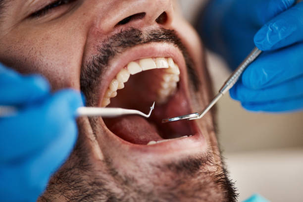 Best Emergency Treatment for Toothache in Knoxvle, IL